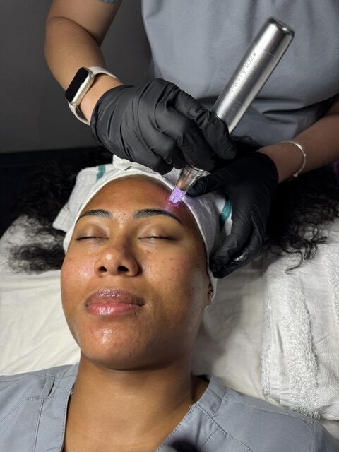 Microneedling Mini Series Buy 3, Get 1 FREE